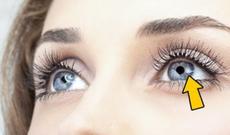 Görmə qabiliyyətini 100 faiz yaxşılaşdıran üsullar