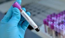 İranda 23 deputat koronavirusa yoluxub