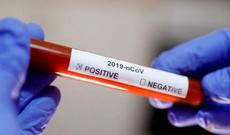 İtaliyada virusdan ölənlər  62-95 yaş arasındadır