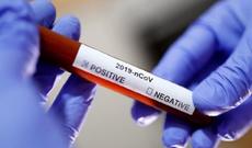 Ukraynada 1 ay müddətində karantin elan edilib