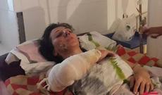 Gəncədə həyat yoldaşın yandıran şəxs saxlanılıb