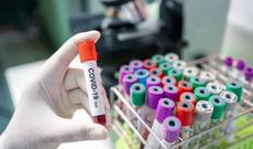 Türkiyədə məktəblər mayın 31-dək bağlı qalacaq